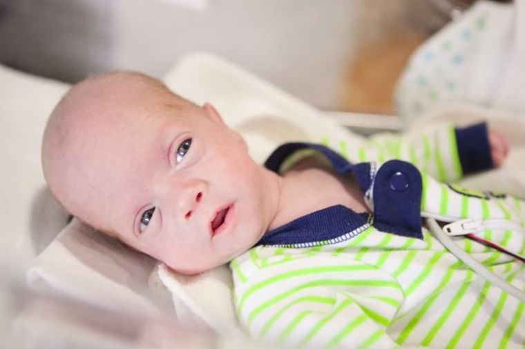 Beba koja je pobedila smrt: 80-dnevna borba dečaka rođenog u 6. mesecu! (FOTO, VIDEO)