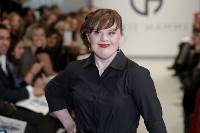 Upoznajte Džejmi Brever: Prvi model sa Daunovim sindromom na modnoj pisti! (FOTO)
