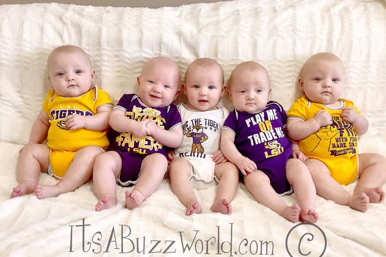 Kada su lekari videli ovih 5 beba, nisu mogli da veruju svojim očima! (FOTO)