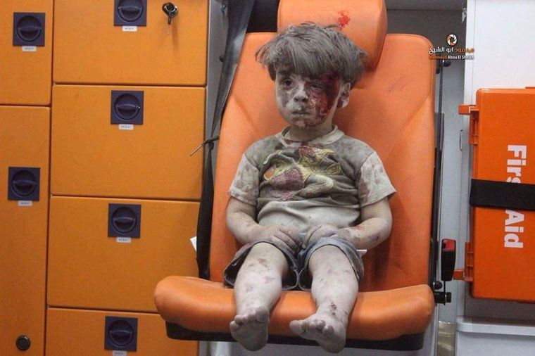 UZNEMIRUJUĆE! Scena koja je rasplakala svet: Povređeni dečak (5) sam nakon bombardovanja! (VIDEO)