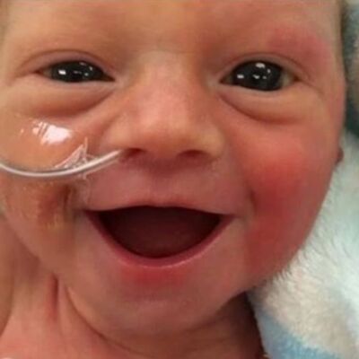 Svi pričaju o osmehu prevremeno rođene bebe: Ona je srećna što je živa! (FOTO)