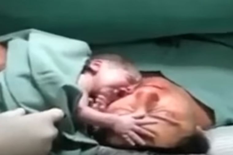 Majka umrla na porođaju, beba plakala sve jače: Čudo koje će lekari zauvek pamtiti! (VIDEO)