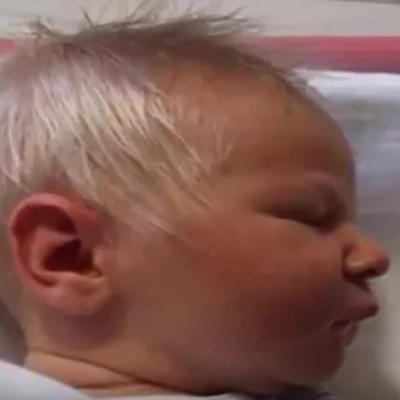 Šokirao lekare kada se rodio: Slika mališana sa razlogom obišla svet! (VIDEO)