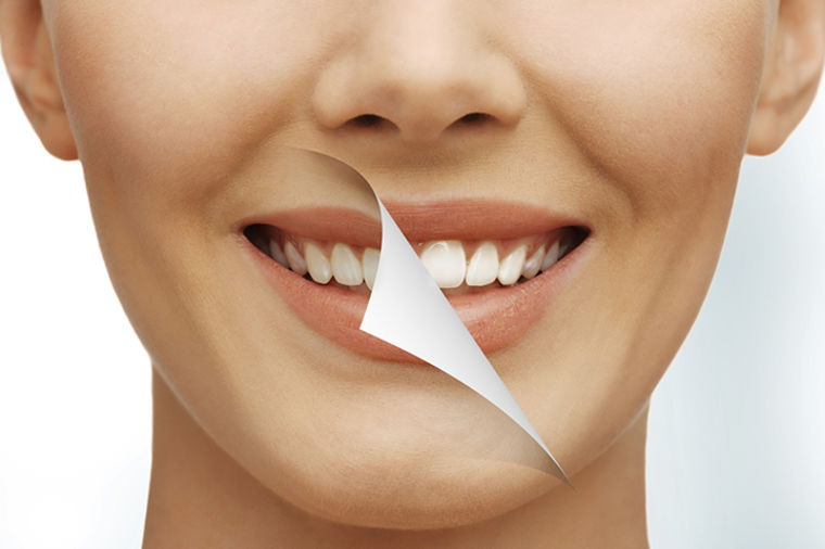 Biserno beli zubi: Izbelite zube kod kuće za samo nekoliko dana – pogledajte kako! (VIDEO)
