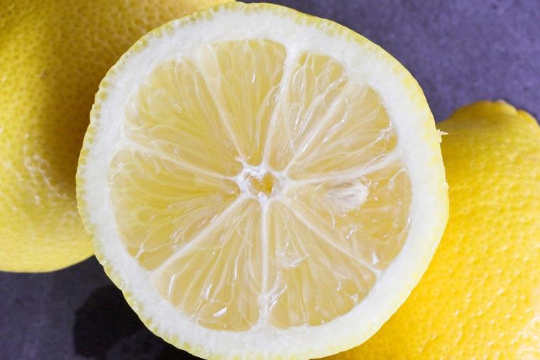 Svi narodni lekovi sa limunom: Za lepšu kožu, liniju i raspoloženje