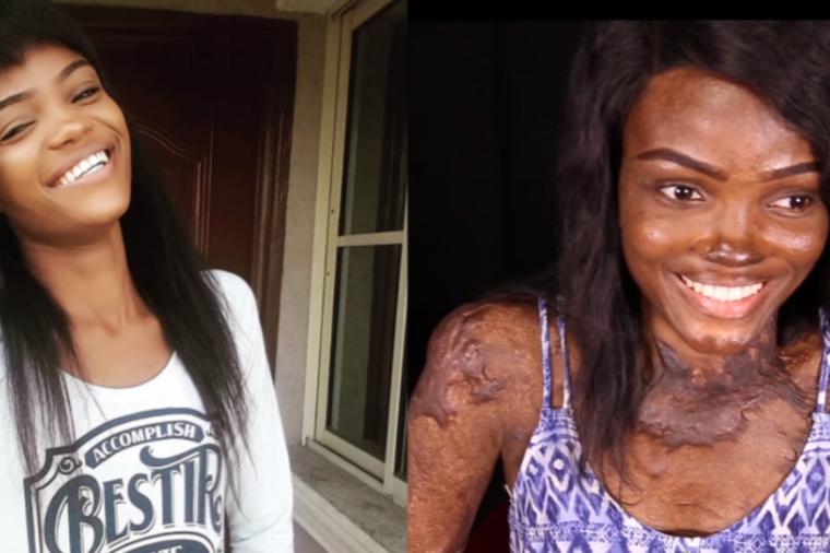 Više nego preživela: Ona je prelepa devojka iz Nigerije (23) koja je pogledala smrti u oči i pobedila je! (FOTO, VIDEO)