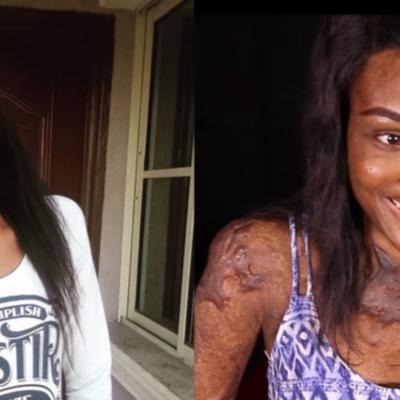 Više nego preživela: Ona je prelepa devojka iz Nigerije (23) koja je pogledala smrti u oči i pobedila je! (FOTO, VIDEO)