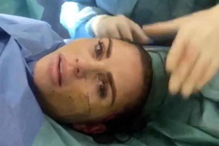 Šokantan snimak Kejti Prajs (40) nije za osetljive: Tokom plastične operacije pričala i snimala dok je doktor radio! (FOTO)