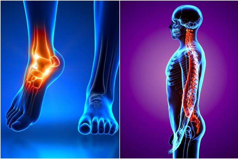 Svaki bol u leđima potiče od stopala: Ove vežbe leče čitav skelet!