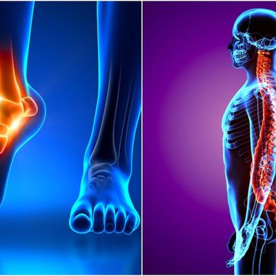 Svaki bol u leđima potiče od stopala: Ove vežbe leče čitav skelet!