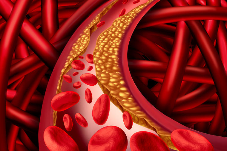 Očistiće zakrčene arterije i regulisati novo holesterola velikom brzinom: Ovih 5 namirnica su moćnije od bilo kog leka!
