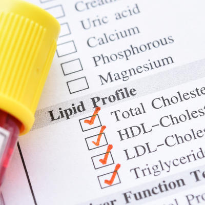 Tihi simptomi koji mogu da ukazuju da patite od povišenog holesterola: Ove signale nikako ne ignorišite!