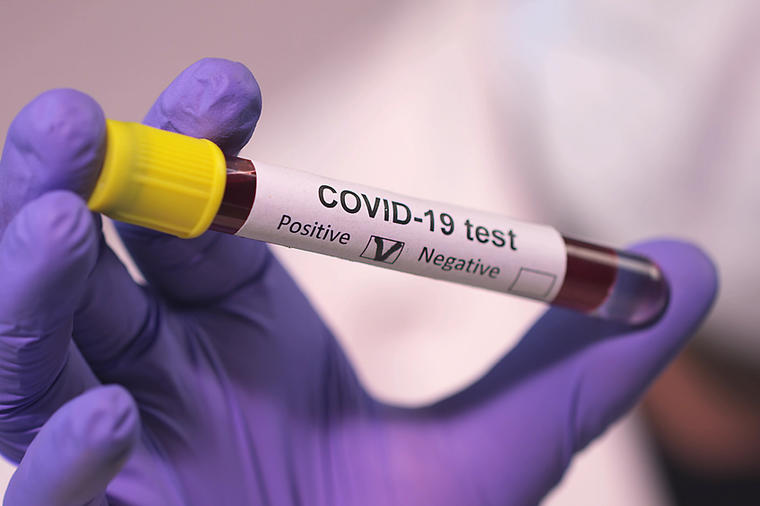 Korona virus u Srbiji: Još 5.809 novozaraženih, 58 preminulih!