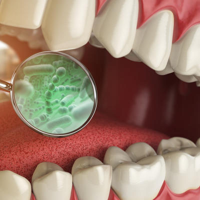 Higijena usta je mnogo više od sprečavanja karijesa i svežeg daha: Neredovno i loše pranje zuba može da vas ubije!