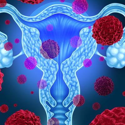 INSTITUT ZA JAVNO ZDRAVLJE: Žene, ovo je sve što treba da znate o raku materice!