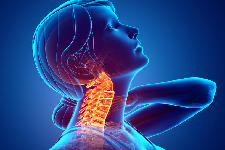 Bol u vratu može da kamuflira ovih 5 stanja: Retko ko bi posumnjao!
