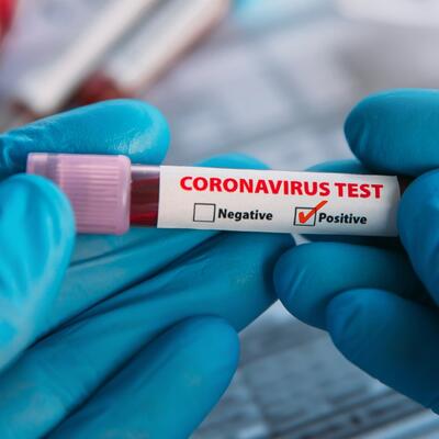 550 NOVOZARAŽENIH: Preminulo još 14 osoba od korona virusa