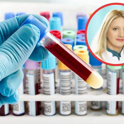 VAŽNO ZA ANEMIJU! PITALI SMO SPECIJALISTU: Koliko treba da čuvamo rezultate krvne slike