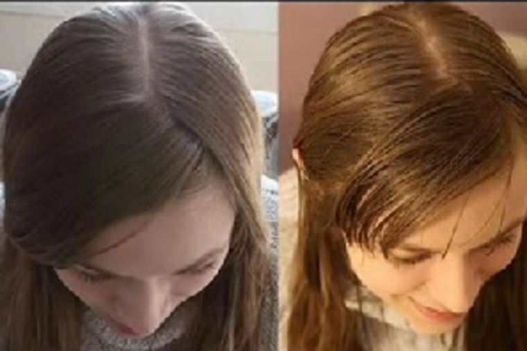 Foto: Youtube / Printscreen / Nakon pranja sodom bikarbonom (levo) i nakon 20 dana eksperimenta (desno)