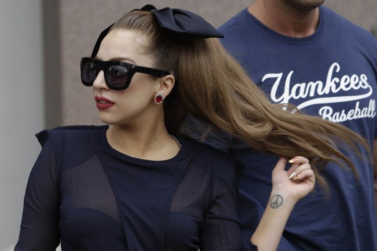Lejdi Gaga: Moja povreda kuka je mnogo gora nego što je predstavljeno