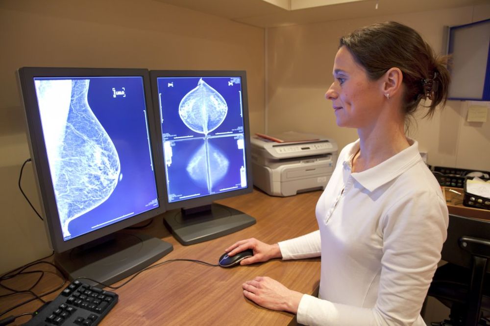 Mamograf, Pregled Dojke, Skener
