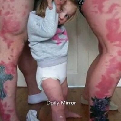 Bizarne tetovaže kao dokaz ljubavi: Da naša ćerka nikad ne pomisli da je drugačija! (VIDEO)