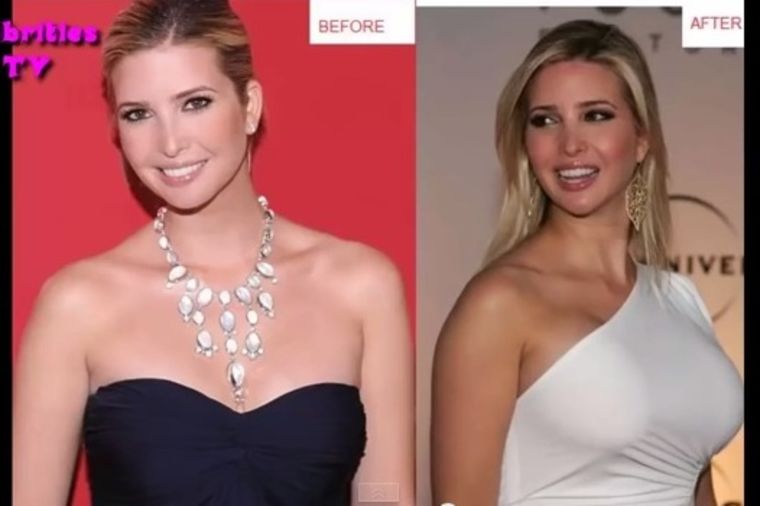 Ivanka Trump Cfake