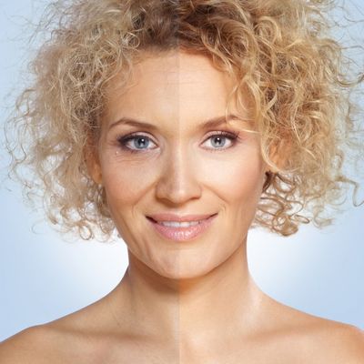 Negujte kožu sirćetom: Četiri moćna efekta po lepotu lica!