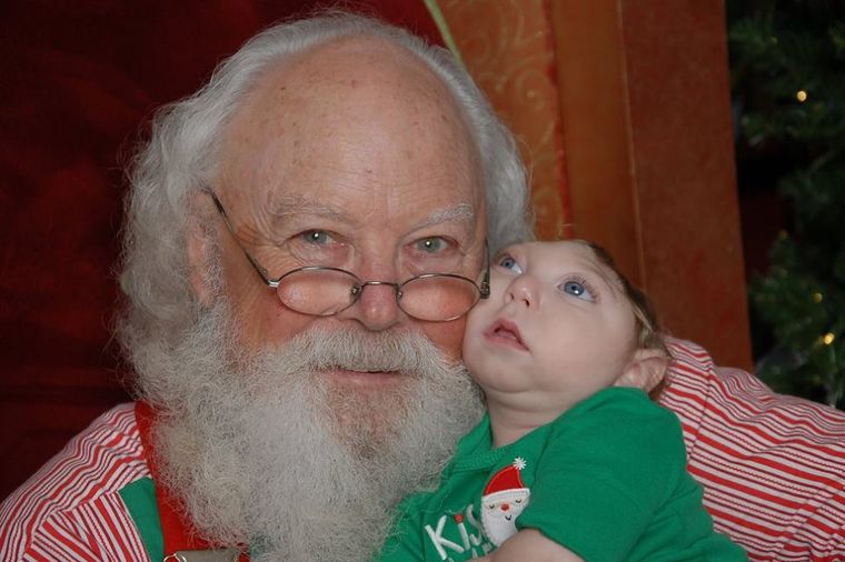 Lekari mu davali samo nekoliko dana života: Beba rođena bez pola lobanje slavi drugi Božić! (FOTO)