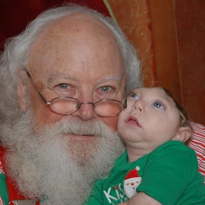 Lekari mu davali samo nekoliko dana života: Beba rođena bez pola lobanje slavi drugi Božić! (FOTO)