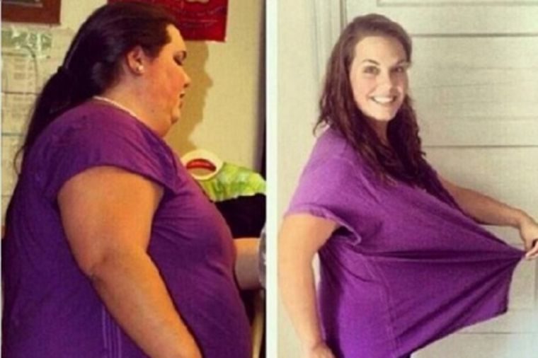 Cela porodica joj umrla zbog gojaznosti: Kako je žena smršala 75 kg i spasila sebi život! (FOTO)