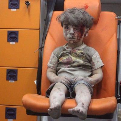 UZNEMIRUJUĆE! Scena koja je rasplakala svet: Povređeni dečak (5) sam nakon bombardovanja! (VIDEO)