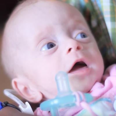 Usvojili bebu bez mozga iz neverovatnog razloga: Dirljiva priča za pamćenje! (VIDEO)