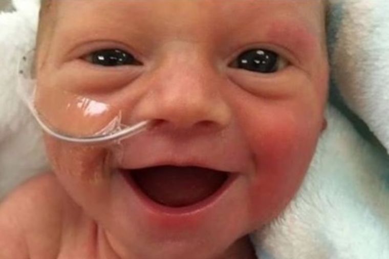 Svi pričaju o osmehu prevremeno rođene bebe: Ona je srećna što je živa! (FOTO)
