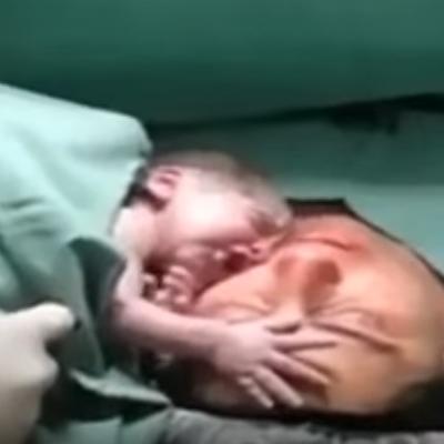 Majka umrla na porođaju, beba plakala sve jače: Čudo koje će lekari zauvek pamtiti! (VIDEO)
