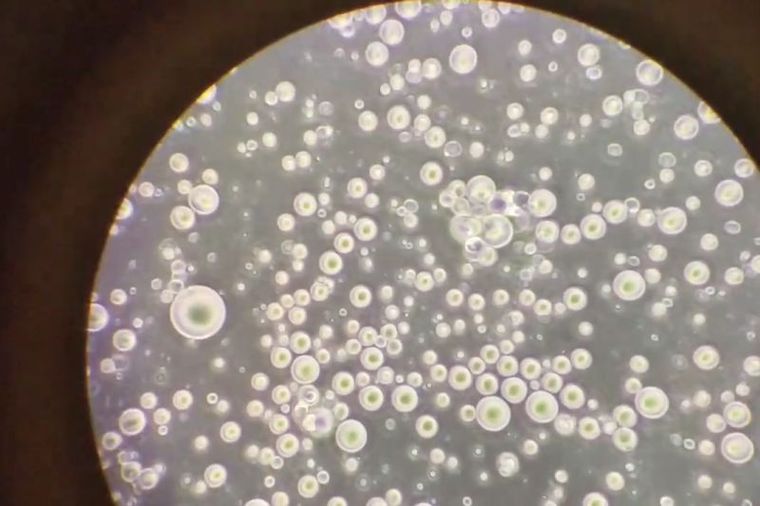 Snimak majčinog mleka pod mikroskopom obišao svet: Ovo je tečno zlato! (VIDEO)