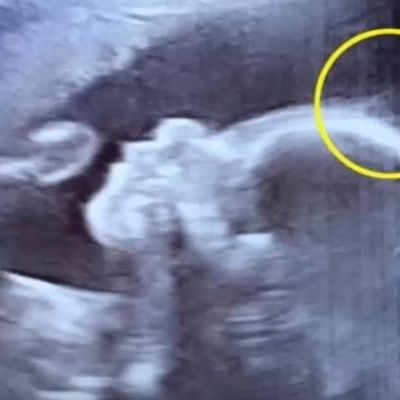 Trudnica otišla na kontrolu kod doktora: Nije verovao svojim očima šta vidi na ultrazvuku! (VIDEO)