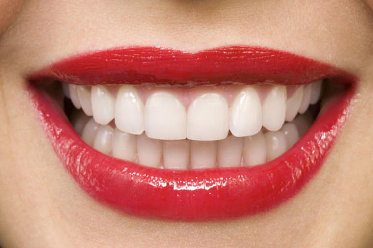 Novi način izbeljivanja zuba: Kako da sami izbelite zube do čak 5 nijansi?