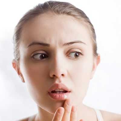 Ublažava bol i upalu: Domaći lek za herpes na usnama!