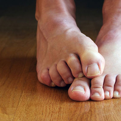 Ledena stopala? Evo kako aluminijumska vlakna mogu da pomognu kod dijabetičkog stopala!
