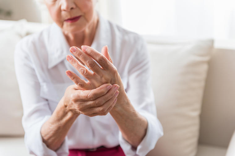 Psorijazni artritis: Bolest imunog sistema koju možete da držite pod kontrolom!