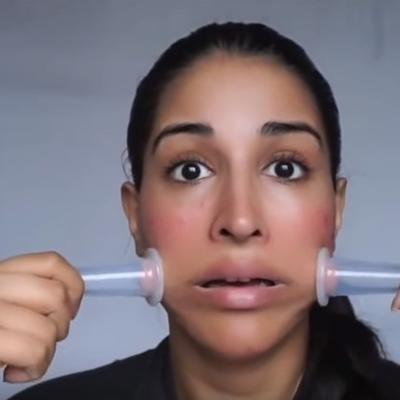 Vakuum lica je pravi svetski hit: Evo čemu služi i kako se vrši tretman! (VIDEO)