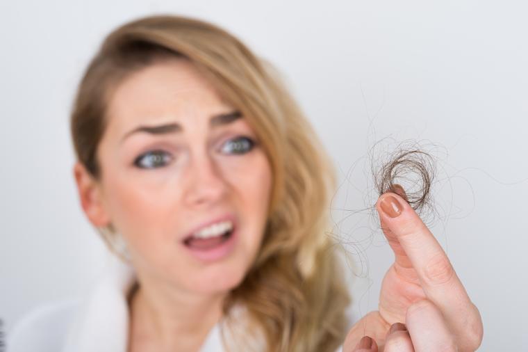 Tinktura protiv opadanja kose: Napravite sami tečnost koja će ojačati dlaku! (RECEPT)
