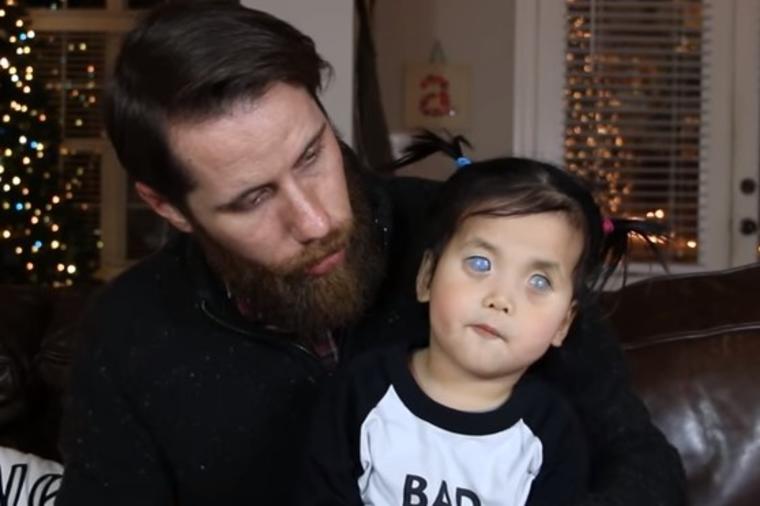 Devojčicu sa srebrnim očima su svi ostavili po rođenju: Živela je u bolovima, niko nije hteo da je usvoji a onda se dogodilo čudo! (VIDEO)