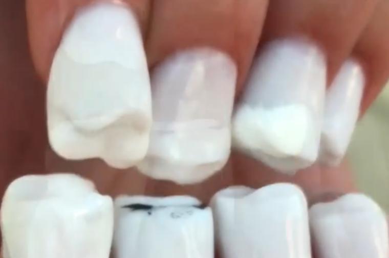 Ružnim trendovima nema kraja: Zubi nokti hit na Instagramu, nećete prestati da se čudite! (FOTO)