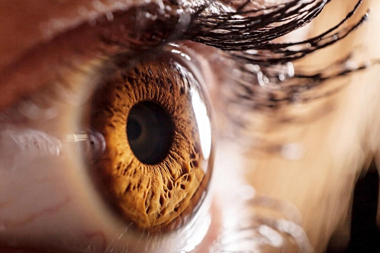 Ovo najviše uništava ljudske oči: Zamućen vid i osetljivost na svetlo su prvi simptomi