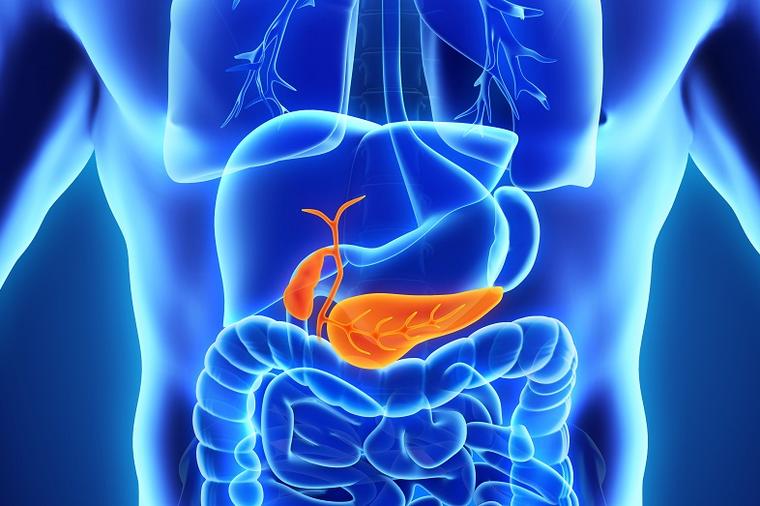 Akutna i hronična upala pankreasa: Prvi simptomi da će vam gušterača stradati