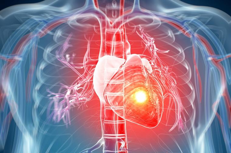 11 simptoma kojima telo upozorava na moguće srčane bolesti