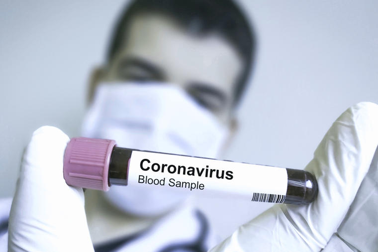 Srbija: 785 osoba zaraženih korona virusom, tri nova smrtna slučaja