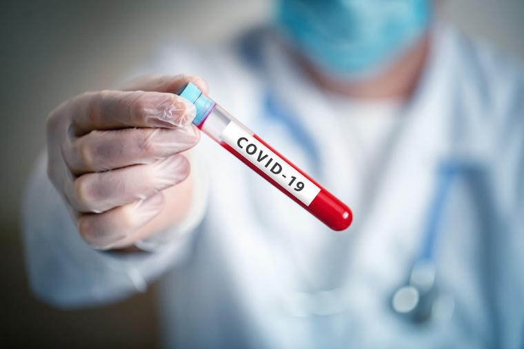 Korona virus u Srbiji: 52 novozaraženih, još dvoje preminulo
